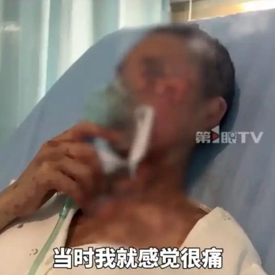 2025年云南女子头孢过敏导致毁容事件