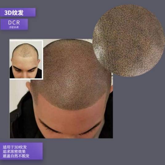 3D纹发