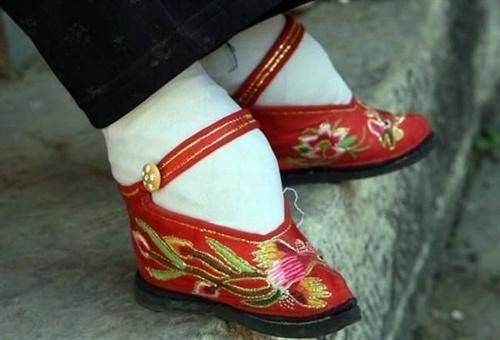 三寸金莲（中国古代女性缠足后形成的小脚）